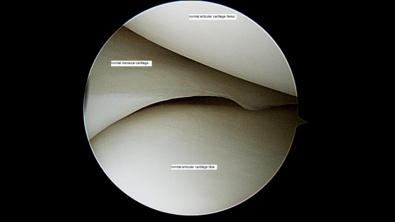 normal-articular-surfaces